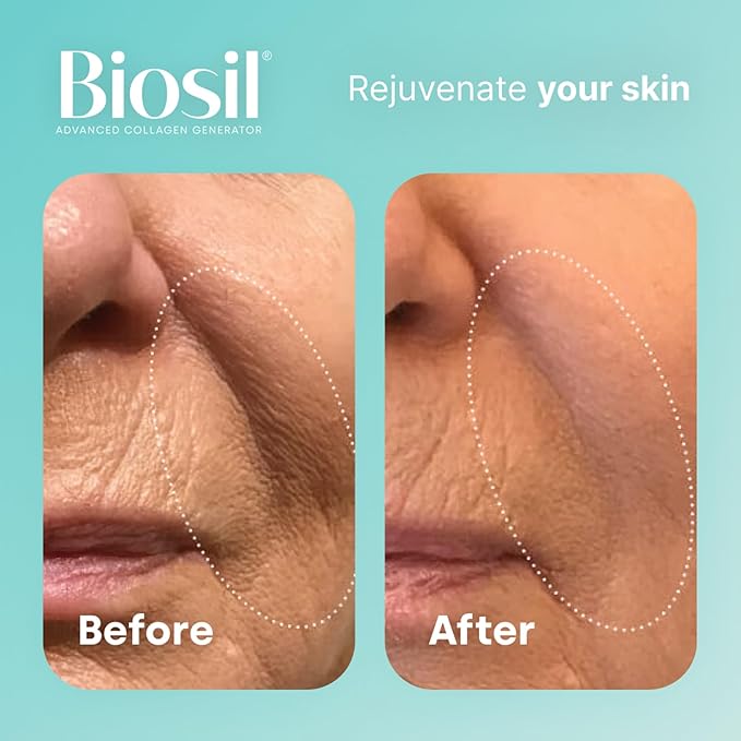 Biosil Collagen Generator - 120 Original Capsules - with Patented ch-OSA Complex - Generates & Protects Your Own Collagen - GMO Free - 60-Day Supply