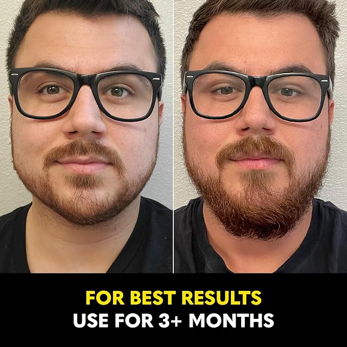 The Beard Club - Beard Growth Vitamins - Support A Thicker Fuller Beard, Fill in Patches - Biotin, Minerals, Multi-Vitamins Help Support and Stimulate Healthier Facial Hair Growth