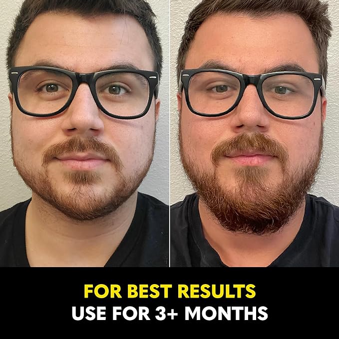 The Beard Club - Beard Growth Vitamins - Support A Thicker Fuller Beard, Fill in Patches - Biotin, Minerals, Multi-Vitamins Help Support and Stimulate Healthier Facial Hair Growth