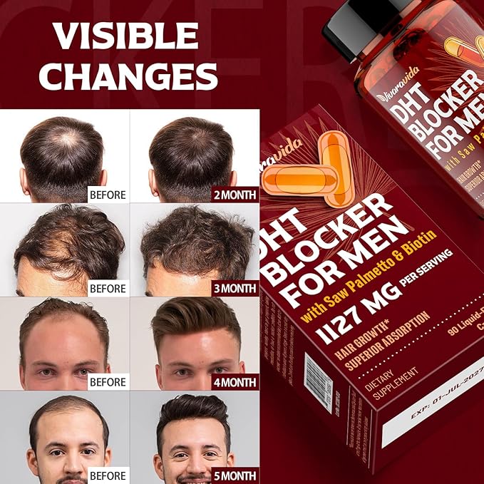 DHT Blocker for Men | Hair Growth Supplement with Saw Palmetto & Biotin - Hair Growth Vitamins - Hair Regrowth - Natural Hair Loss Supplements Liquid-Filled - Proprietary Herbal Blends (90 Capsules)