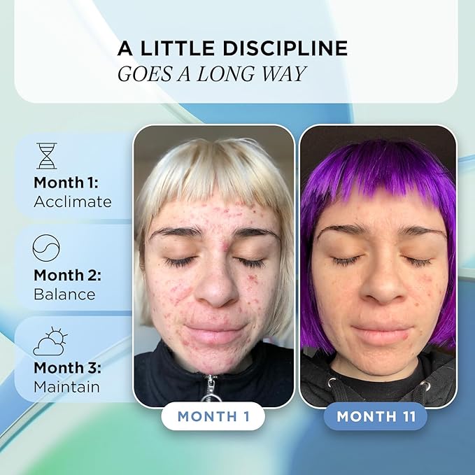 ZitSticka Vitamin Acne Supplement for Cystic Acne w/ 30 Natural Caps for Women and Men, Supplements for Hormonal Support, Skin Clarity, Dark Spots - Dermatologist Tested (Skin Discipline)