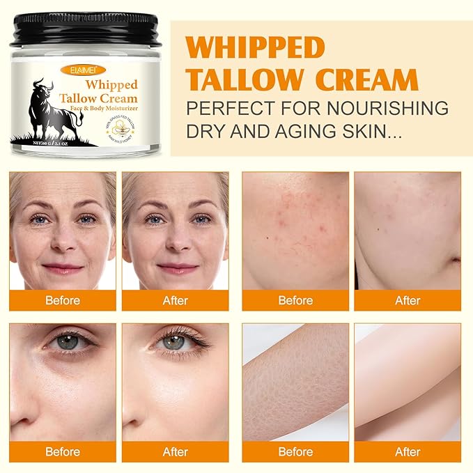 2PCS Beef Tallow and Honey Cream for Skin, Moisturizer Cream, Whipped Tallow Cream for Smooth Nourishing Face & Body, Natural Beef Tallow Balm for Skin Care, Beef Tallow, Butter and Honey Balm